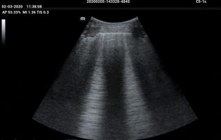 ME8 Image: lung