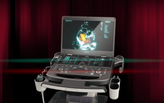 me8 ultrasound system