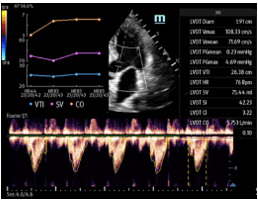 cardiac assessment