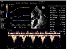 smart vti scan