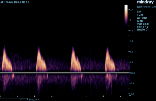cw transducer card