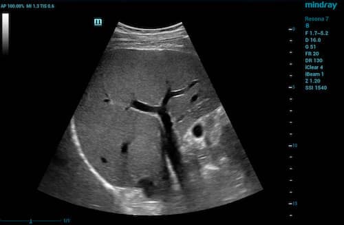 ultrasound transducer image