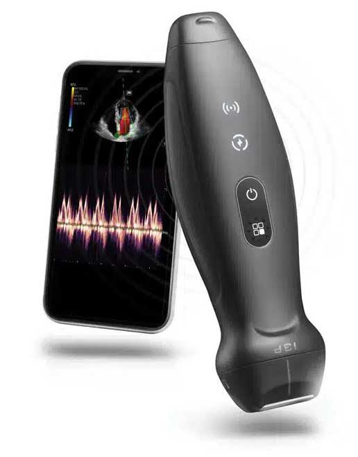 Laptop Portable Ultrasound
